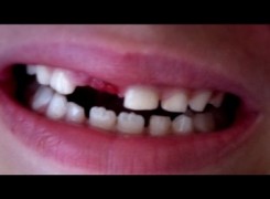 Petit_130929_dents_523